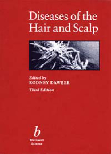 Diseases of the Hair and Scalp