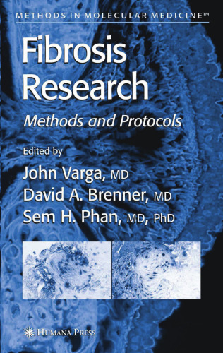 Fibrosis Research: Methods and Protocols