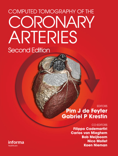 Computed Tomography of the Coronary Arteries
