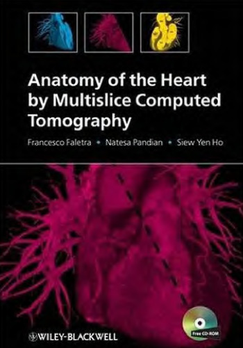 Anatomy of the Heart by Multislice Computed Tomography
