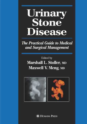 Urinary Stone Disease: The Practical Guide to Medical and Surgical Management