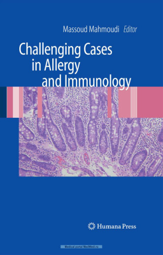 Challenging Cases in Allergy and Immunology